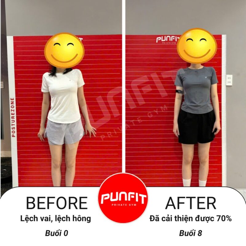 Kết quả khách hàng hiệu chỉnh sai lệch tư thế lệch hông lệch vai PUNFIT - Private Gym